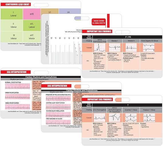 EKG Horizontal Badge 6 Card Set, ECG Telemetry Cards with EKG Ruler, Electrocardiogram Rhythm Interpretations, Common Cardiac Findings, STEMI Leads, 12 Lead EKG Placement (Bonus Cheat Sheets)
